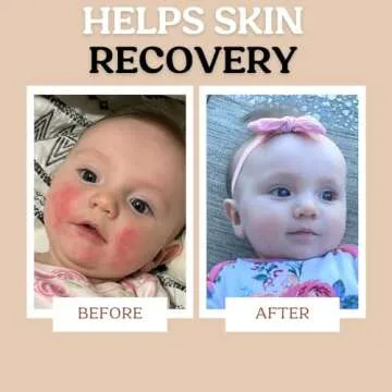 Roe Wellness Power Pair for Sensitive Skin Care Solutions