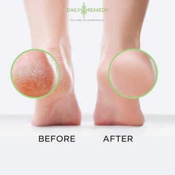 Tea Tree Oil Foot Soak to Soften Calluses and Soothe Feet