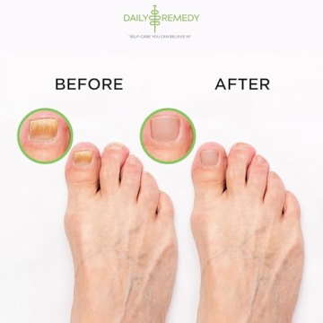 Tea Tree Oil Foot Soak to Soften Calluses and Soothe Feet