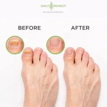 Tea Tree Oil Foot Soak to Soften Calluses and Soothe Feet