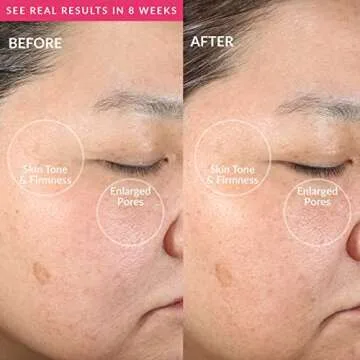 PMD Clean - Smart Facial Cleansing Device with Silicone Brush & Anti-Aging Massager - Waterproof - SonicGlow Vibration Technology - Clear Pores and Blackheads - Lift, Firm, and Tone Skin