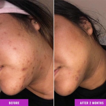 Good Molecules Discoloration Correcting Serum for Dark Spots