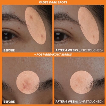 Innisfree Green Tea Enzyme Vitamin C Brightening Serum