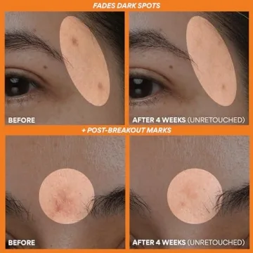 Innisfree Green Tea Enzyme Vitamin C Brightening Serum