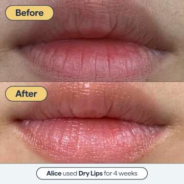 Remedy for Dry Lips - Hydrating Healing Lip Balm Ointment