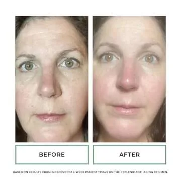 Replenix Pure Hydration Hyaluronic Acid Serum - Medical Grade Anti-Aging Treatment, Reduces Appearance of Wrinkles, Uneven Skin Tone, Firming, 1 oz.