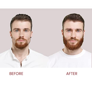 Biotin Hair Growth Shampoo for Men & Women