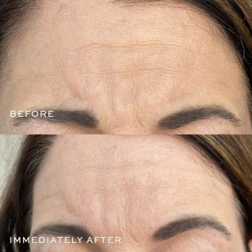 Anti-Aging DIME Beauty Super Firm Facial Serum