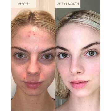 MARA Algae Retinol Face Oil | Anti-Aging & Hydrating Skin Care