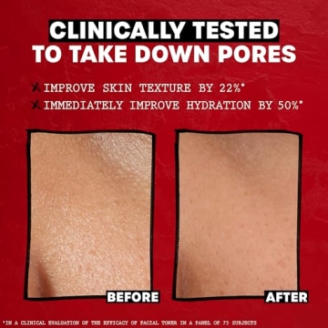 THAYERS Cucumber Witch Hazel Toner for Hydrated Skin