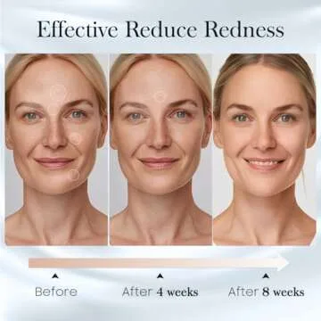 Fygrip 100 Count (2 Box) XL Disposable Face Towels 10” x 12”, 100% Viscose Fibre, Soft & Skin Friendly Face Towelettes Disposable, Facial Tissue Face Wipes for Women Cleansing