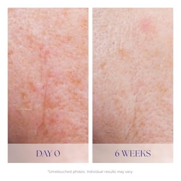 iS CLINICAL Active Serum for Youthful Glowing Skin