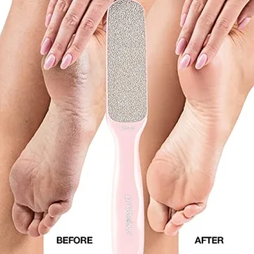 Probelle Foot File: Ultimate Callus Remover Tool for Smooth Feet