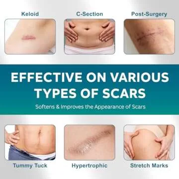 Silicone Scar Sheets, Silicone Scar Tape(1.6"x 120" Roll-300CM), Silicone Tape for Scars, Scar Tape for Surgical Scars, Silicone Scar Strips for C-Section, Tummy Tuck, Keloid, and Surgical Scars