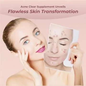 Hormonal Acne Supplements for Women | PureHealth Research