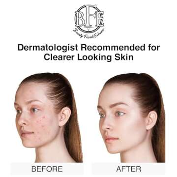 Advanced Acne Treatment Pads - Clear Breakouts Fast!