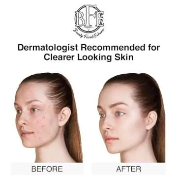 Advanced Acne Treatment Pads - Clear Breakouts Fast!