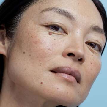 Obagi Nu-Derm Exfoderm Forte – Advanced, Lightweight Exfoliating Lotion with Glycolic and Lactic Acids (AHA) – For Normal to Oily Skin Types – 2 oz