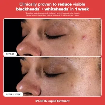 Paula's Choice Exfoliation Kit, Travel-Size Duo for Glowing Skin