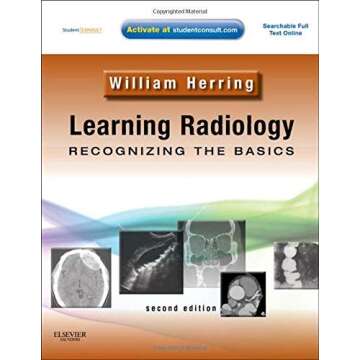 By William Herring - Learning Radiology: Recognizing the Basics (With STUDENT CONSULT Online Access)...