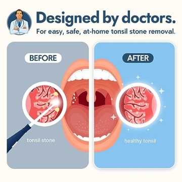 Dr. Frederick’s Easy Tonsil Stone Removal Kit for Fast Relief
