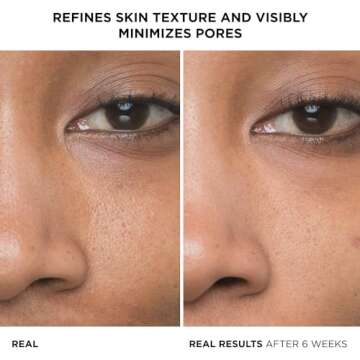 IT Cosmetics Bye Bye Pores 10% Glycolic Acid Face Serum - Visibly Minimizes Pores In 1 Week & Gently Exfoliates to Help Refine Skin’s Texture - With Hyaluronic Acid for Hydration -1 Fl. Oz