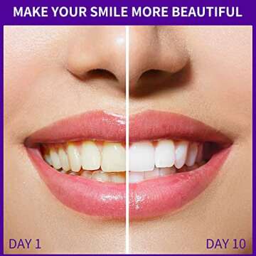 GlorySmile Purple Teeth Whitening Foam, Dental Color Corrector, Yellow Stain Removal, 1.75 Fl Oz