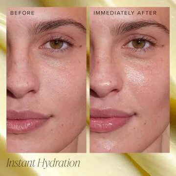 Farmacy Ceramide Face Moisturizer - Honey Halo Hydrating Facial Moisturizer for Dry Skin - Plumps, Soothes + Restores Skin with Potent Ceramides + Buckwheat Honey for a Dewy, Healthy Glow (100ml)