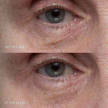 Alpyn Triple-C Bounce Cream | Hydrating Gel to Brighten Skin