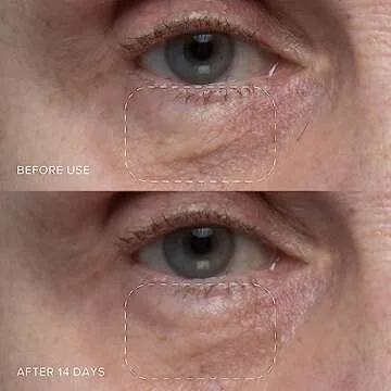 Alpyn Triple-C Bounce Cream | Hydrating Gel to Brighten Skin