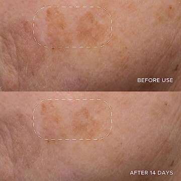 Alpyn Triple-C Bounce Cream | Hydrating Gel to Brighten Skin