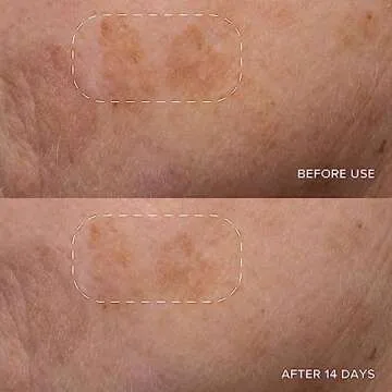 Alpyn Triple-C Bounce Cream | Hydrating Gel to Brighten Skin