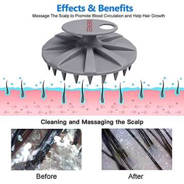 INNERNEED Scalp Massager for Hair Growth & Dandruff Relief