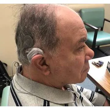 Ear Gear Cochlear Mono – Ultimate Protection for Implants