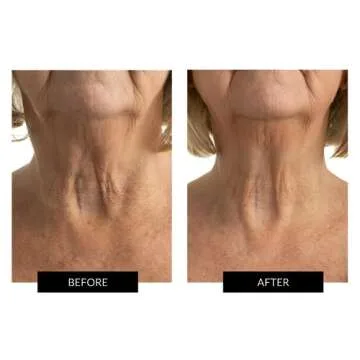 CurrentBody Skin LED Neck and Dec Perfector | Fully Wearable Anti-Aging LED Mask & Device for Neck & Décolletage | Red Light Therapy Treatment for Wrinkle Reduction