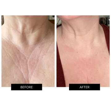 CurrentBody Skin LED Neck and Dec Perfector | Fully Wearable Anti-Aging LED Mask & Device for Neck & Décolletage | Red Light Therapy Treatment for Wrinkle Reduction