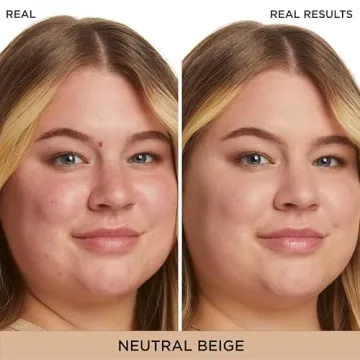 IT Bye Bye Redness Cream - Neutralizes Redness Effectively