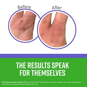 Revive Your Hands with O’Keeffe’s Night Treatment Cream