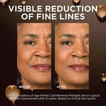 L'Oreal Paris Age Perfect Anti-Aging Midnight Face Serum, Reduce Wrinkles 1oz + Eye Cream Sample