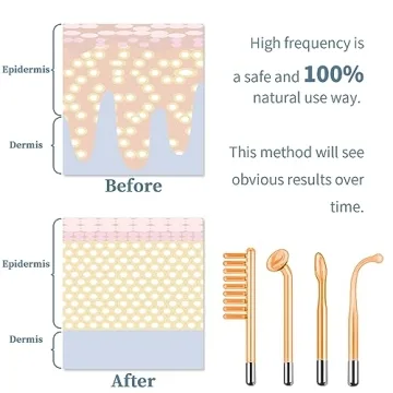 TUMAKOU Portable High Frequency Facial Machine with Tubes