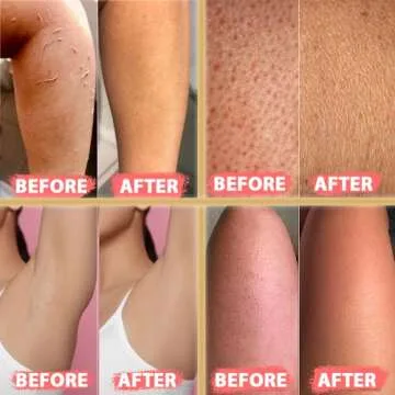 (1 Count Medium) Kelebek Premium Natural Exfoliating Gloves, Turkish Hammam Kese, Original Exfoliating Mitt, Body Scrub for Men and Women