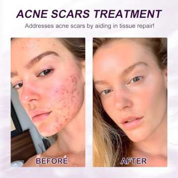 Marianp Hyaluronic Acid Serum with Azelaic Acid 10%