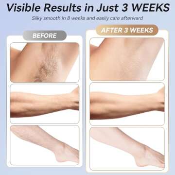 EUARNE IPL Hair Removal Device with Cooling Technology