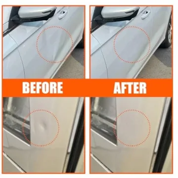 YIHANGYE 7 Pack Dent Puller Kit for Easy Fixes