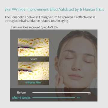 Genabelle Edelweiss Lifting Serum – Anti-Aging Formula with Edelweiss Extract, Niacinamide, Peptides for Firming, Hydration & Brightening – 1.35 fl.oz