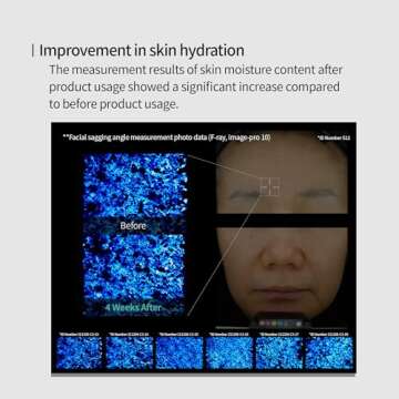 Genabelle Edelweiss Lifting Serum – Anti-Aging Formula with Edelweiss Extract, Niacinamide, Peptides for Firming, Hydration & Brightening – 1.35 fl.oz