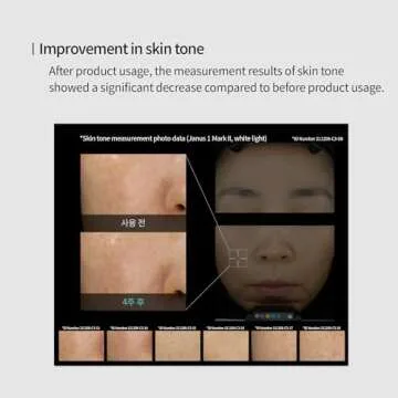 Genabelle Edelweiss Lifting Serum – Anti-Aging Formula with Edelweiss Extract, Niacinamide, Peptides for Firming, Hydration & Brightening – 1.35 fl.oz