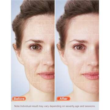 Red Light therapy Mask for Face Wrinkles,Blue Light therapy for Face Acne,Silicone Portable Led Faci...