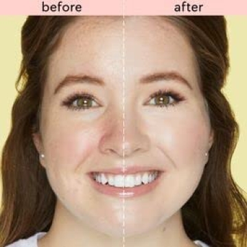 Tarte Skin Treat Concealer for Dark Circles and Flawless Skin