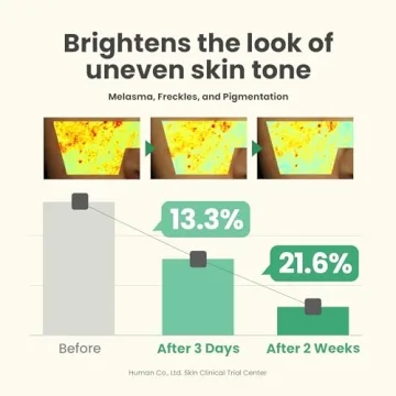 AXIS-Y Dark Spot Glow Serum - Skin Brightening Solution